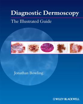 Paperback Diagnostic Dermoscopy: The Illustrated Guide Book