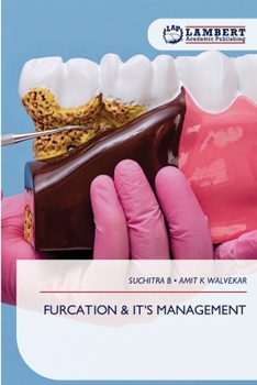 Furcation & It's Management