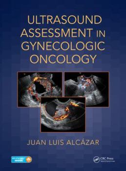 Hardcover Ultrasound Assessment in Gynecologic Oncology Book