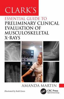 Paperback Clark's Essential Guide to Preliminary Clinical Evaluation of Musculoskeletal X-Rays Book