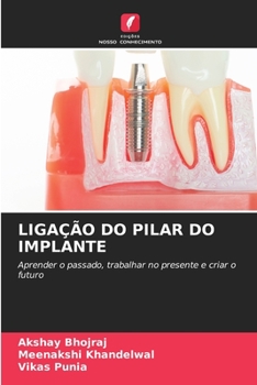 Paperback Ligação Do Pilar Do Implante [Portuguese] Book