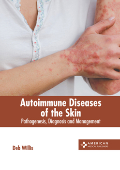 Hardcover Autoimmune Diseases of the Skin: Pathogenesis, Diagnosis and Management Book