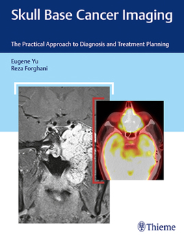 Hardcover Skull Base Cancer Imaging: The Practical Approach to Diagnosis and Treatment Planning Book