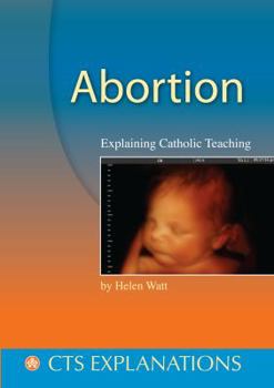 Paperback Abortion (CTS Explanations) Book