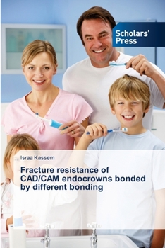 Paperback Fracture resistance of CAD/CAM endocrowns bonded by different bonding Book