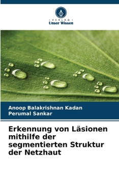 Paperback Erkennung von Läsionen mithilfe der segmentierten Struktur der Netzhaut [German] Book
