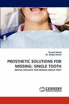 Paperback Prosthetic Solutions for Missing: Single Tooth Book