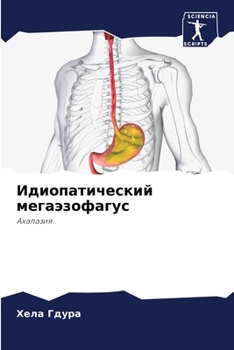 Paperback Идиопатический мегаэзо&# [Russian] Book