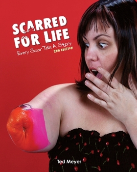Paperback Scarred for Life. 2nd Edition: Every Scar Tells A Story Book