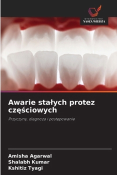 Awarie stalych protez czesciowych (Polish Edition)