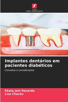 Paperback Implantes dentários em pacientes diabéticos [Portuguese] Book