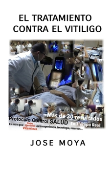 Paperback El tratamiento contra el Vitiligo: Descubre las ventajas del Nuevo Tratamiento [Spanish] Book