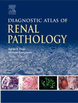 Hardcover Diagnostic Atlas of Renal Pathology: A Companion to Brenner and Rector's the Kidney Book