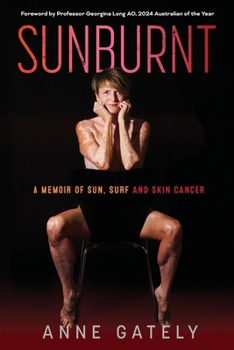 Paperback Sunburnt: A memoir of sun, surf and skin cancer Book