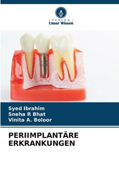 Paperback Periimplantäre Erkrankungen [German] Book