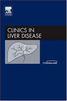 Hardcover Management of Difficult Clinical Problems in Hepatology, An Issue of Clinics in Liver Disease (Volume 10-2) (The Clinics: Internal Medicine, Volume 10-2) Book
