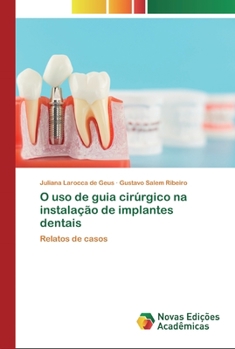 Paperback O uso de guia cirúrgico na instalação de implantes dentais [Portuguese] Book