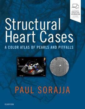 Hardcover Structural Heart Cases: A Color Atlas of Pearls and Pitfalls Book