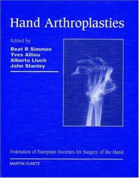 Hardcover Hand Arthroplasties: Published in Association with the Federation of European Societies for Surgery of the Hand Book