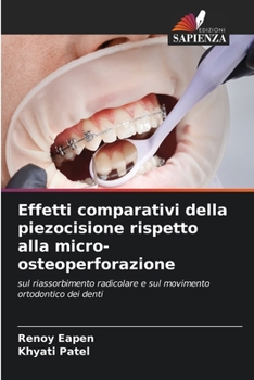 Paperback Effetti comparativi della piezocisione rispetto alla micro-osteoperforazione [Italian] Book