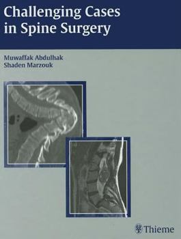 Hardcover Challenging Cases in Spine Surgery: Book