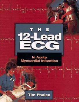Paperback The 12-Lead ECG in Acute Myocardial Infarction Book