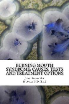 Paperback Burning Mouth Syndrome: Causes, Tests and Treatment Options Book