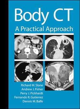 Hardcover Body CT: A Practical Approach Book