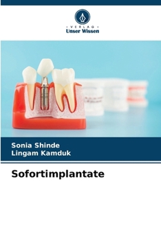 Paperback Sofortimplantate [German] Book
