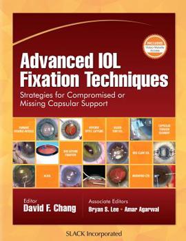 Hardcover Advanced Iol Fixation Techniques: Strategies for Compromised or Missing Capsular Support Book