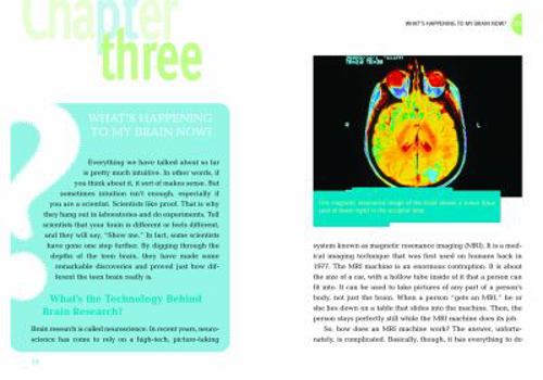 Library Binding Frequently Asked Questions about How the Teen Brain Works Book