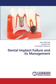 Paperback Dental Implant Failure and its Management Book