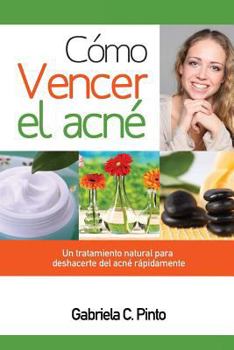 Paperback Cómo Vencer el Acné: Un tratamiento natural para deshacerte del acné rápidamente [Spanish] Book