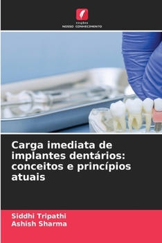 Carga imediata de implantes dentários: conceitos e princípios atuais (Portuguese Edition)