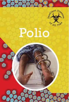 Polio - Book  of the Deadliest Diseases of All Time