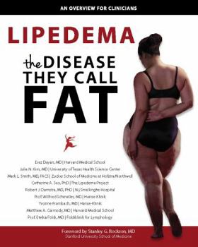 Paperback Lipedema - The Disease They Call FAT: An Overview for Clinicians Book