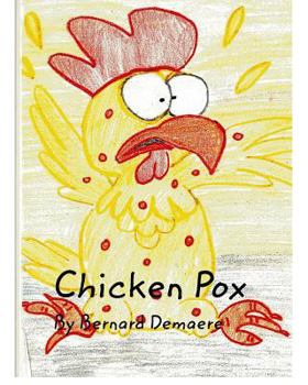 Paperback Chicken Pox Book