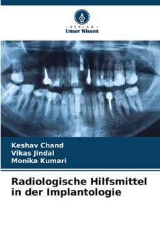 Paperback Radiologische Hilfsmittel in der Implantologie [German] Book