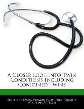 A Closer Look into Twin Conditions Including Conjoined Twins