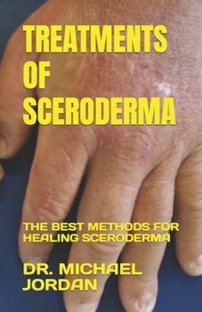 Paperback Treatments of Sceroderma: The Best Methods for Healing Sceroderma Book