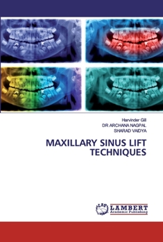 Paperback Maxillary Sinus Lift Techniques Book