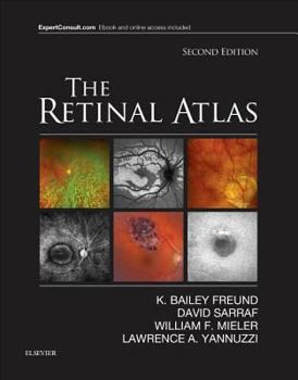 Hardcover The Retinal Atlas Book