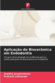 Paperback Aplicação de Biocerâmica em Endodontia [Portuguese] Book