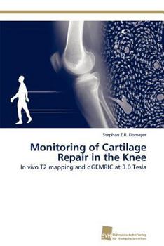 Paperback Monitoring of Cartilage Repair in the Knee Book