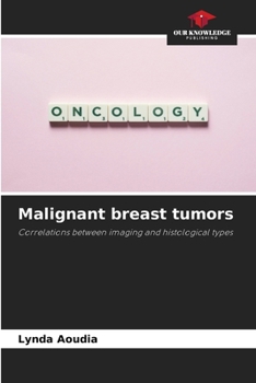 Paperback Malignant breast tumors Book
