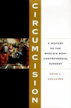 Hardcover Circumcision: A History of the World's Most Controversial Surgery Book