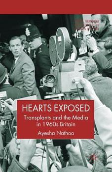 Paperback Hearts Exposed: Transplants and the Media in 1960s Britain Book