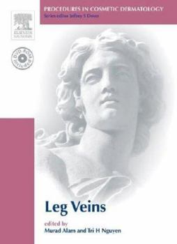 Procedures in Cosmetic Dermatology Series: Treatment of Leg Veins: Textbook with DVD (Procedures in Cosmetic Dermatology)