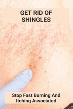 Paperback Get Rid Of Shingles: Stop Fast Burning And Itching Associated: Shingles On Face Treatment Book
