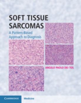 Hardcover Soft Tissue Sarcomas Hardback with Online Resource: A Pattern-Based Approach to Diagnosis Book